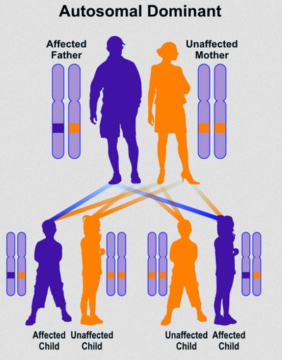 Autosomal dominant inheritance of Waardenburg syndrome image