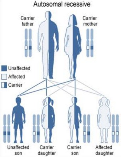 Autosomal recessive Waardenburg syndrome picture