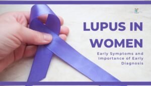 Lupus in Women- Early Symptoms and Importance of Early Diagnosis