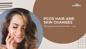 PCOS Hair and Skin Changes- Managing Acne and Hair Loss