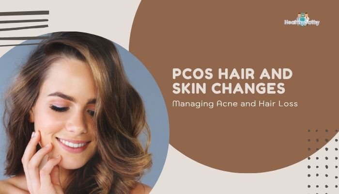 PCOS Hair and Skin Changes- Managing Acne and Hair Loss