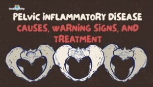 Pelvic Inflammatory Disease- Causes, Warning Signs, and Treatment
