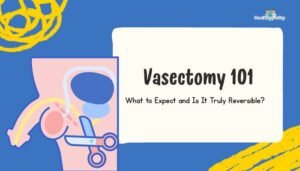 Vasectomy 101- What to Expect and Is It Truly Reversible?