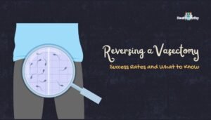 reversing a vasectomy Success Rates and What to Know