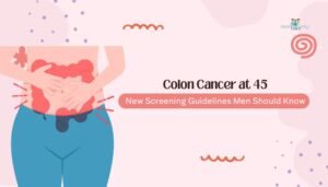 Colon Cancer at 45: New Screening Guidelines Men Should Know